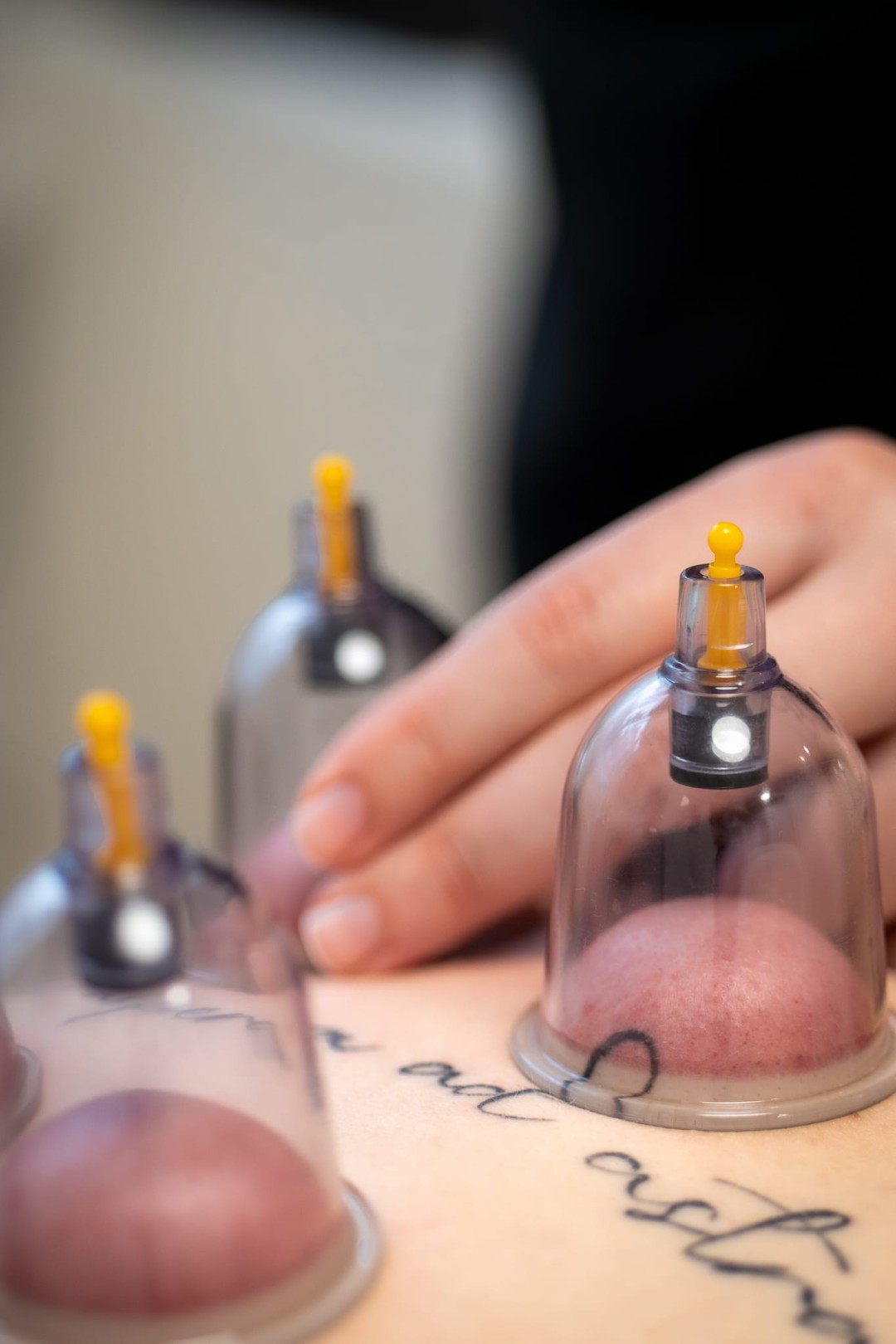 Fizio Touch #zagreb Tretmani tijela Cupping tretman tijela