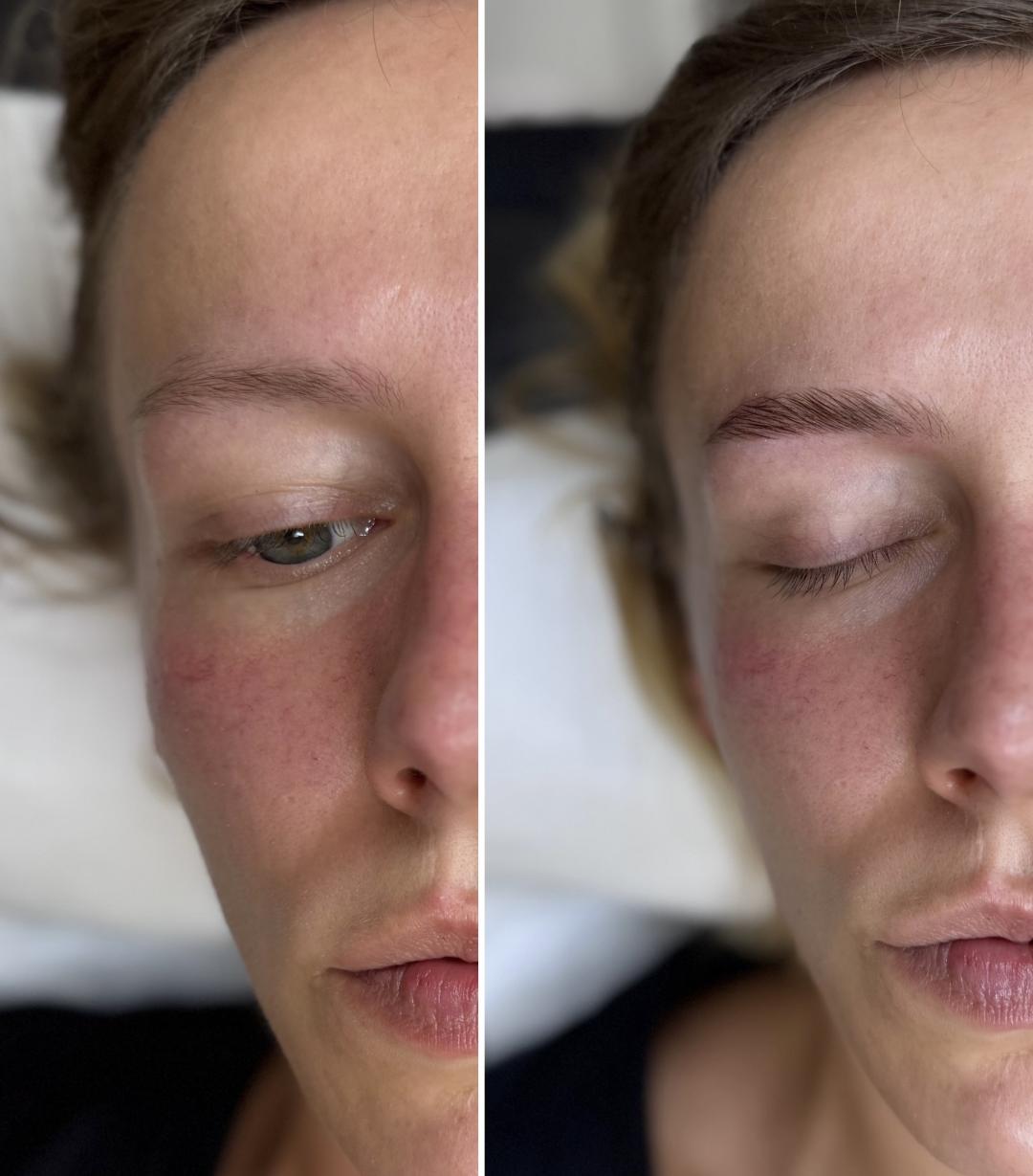 Anova Aesthetics #zagreb Obrve Brow lift + bojanje + oblikovanje obrva