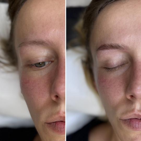 Anova Aesthetics #zagreb Obrve Brow lift + bojanje + oblikovanje obrva