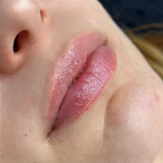 Théa Beauty Spot usluga