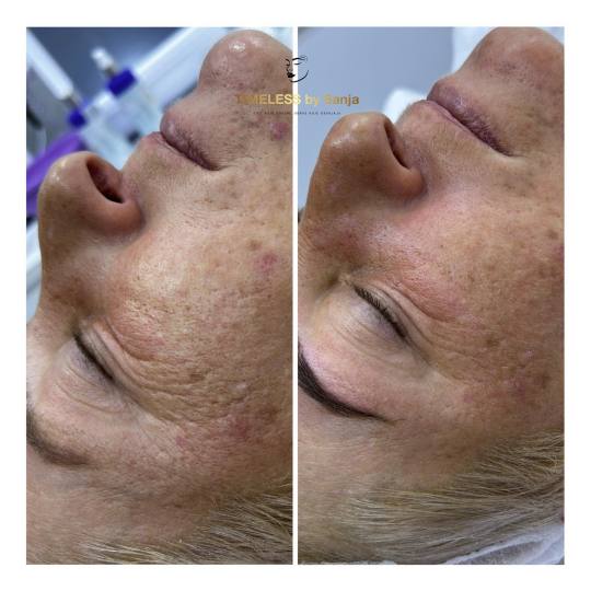 Timeless by Sanja usluga