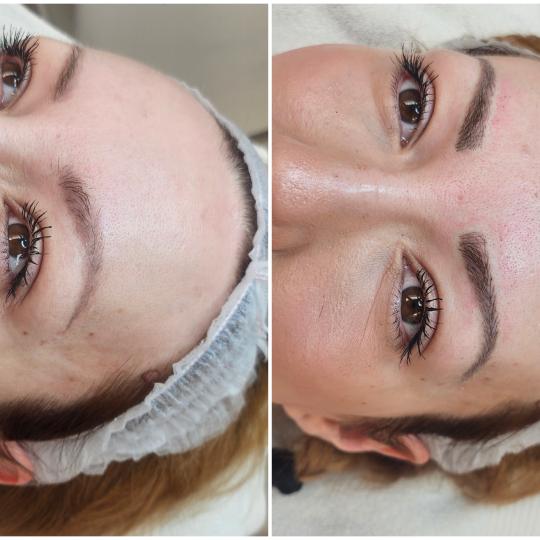 Cosmoderm & Centar Estetica #zagreb Trajna šminka Trajna šminka - iscrtavanje dlačica (hiper real