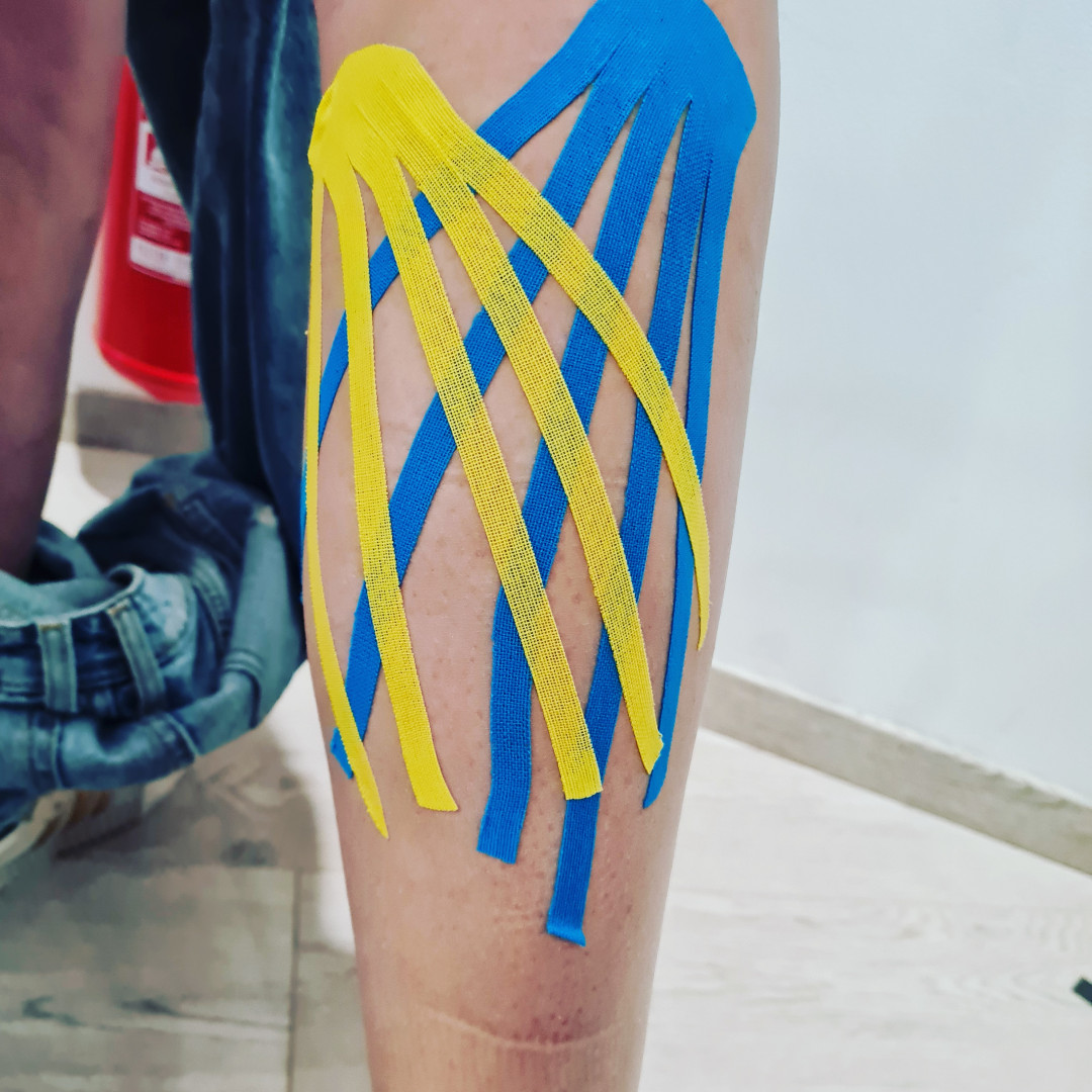 Kinesiotaping - aplikacija po segmentu - Studio Fizio Fit, Rijeka Tretmani tijela Tijelo Tretmani tijela, Rijeka, Zamet