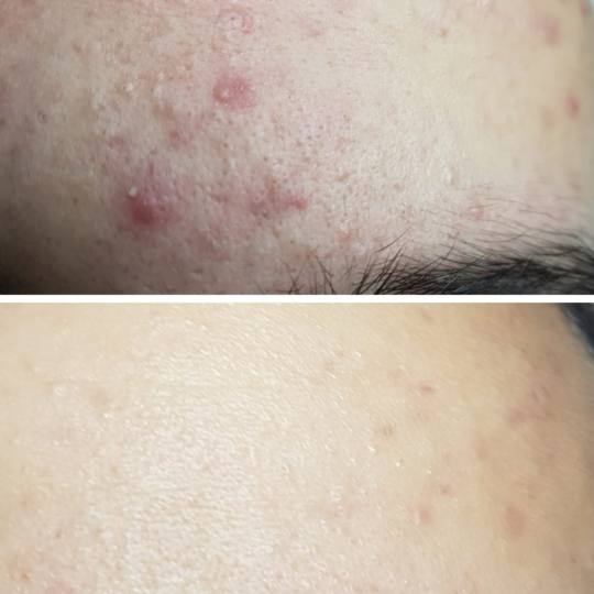 Cosmoderm & Centar Estetica usluga