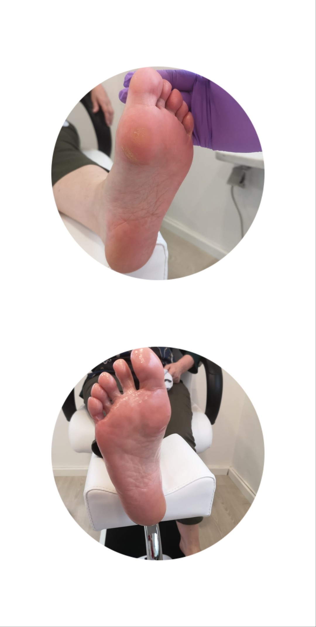 Ruska pedikura - LM Beauty Studio, Zagreb Estetska pedikura Nokti Estetska pedikura, Zagreb, Gornja Dubrava