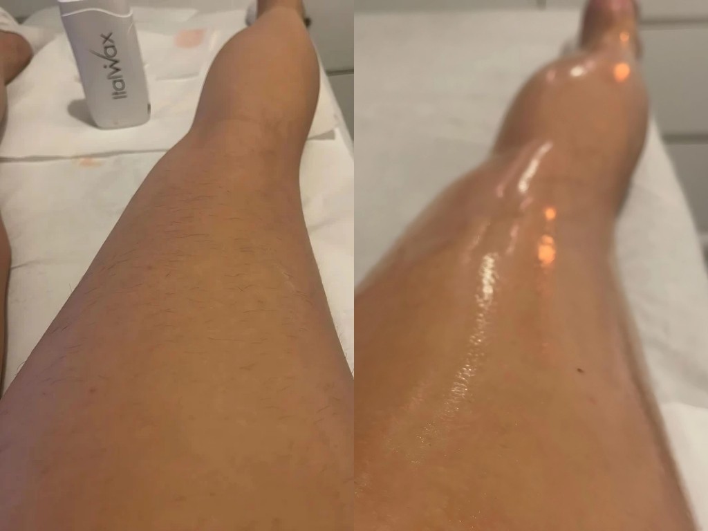Madero&Beauty Gabrijela #zagreb Depilacija nogu Depilacija cijelih nogu toplim voskom - za dame