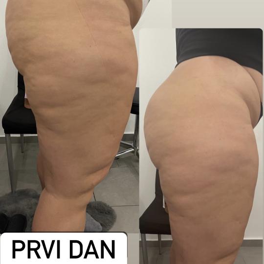 Perfect body beauty bar usluga
