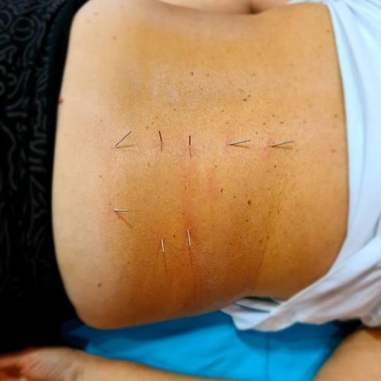 Čarobni dodir #osijek