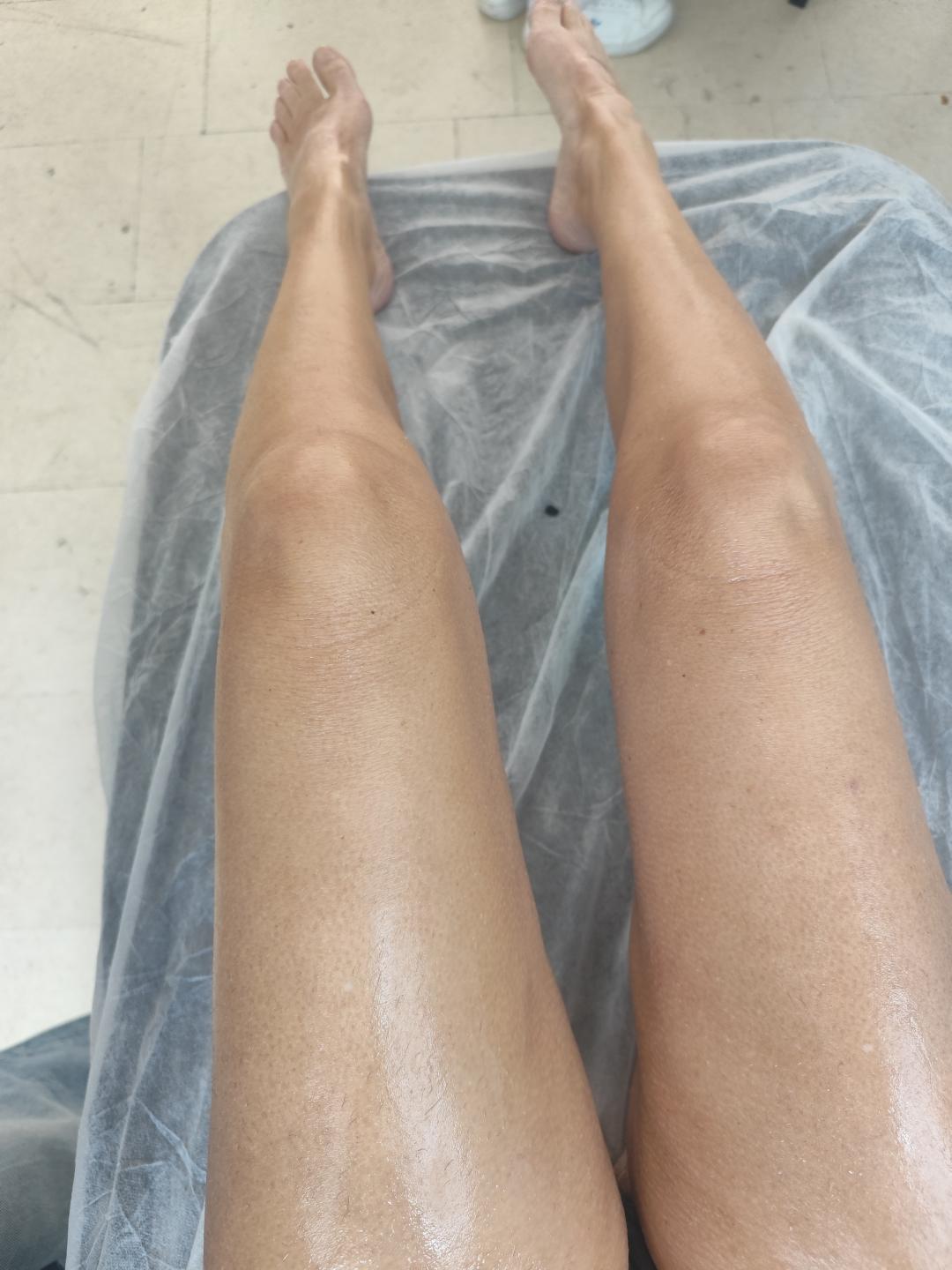 Josea beauty studio #zagreb Depilacija nogu Depilacija cijelih nogu hladnim voskom - za dame