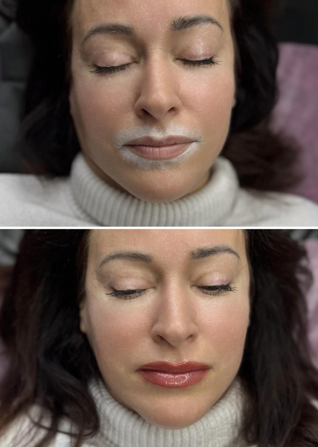 Anova Aesthetics #zagreb Trajna šminka Trajna šminka - usne (sa korekcijom nakon 4-6 tjedana)