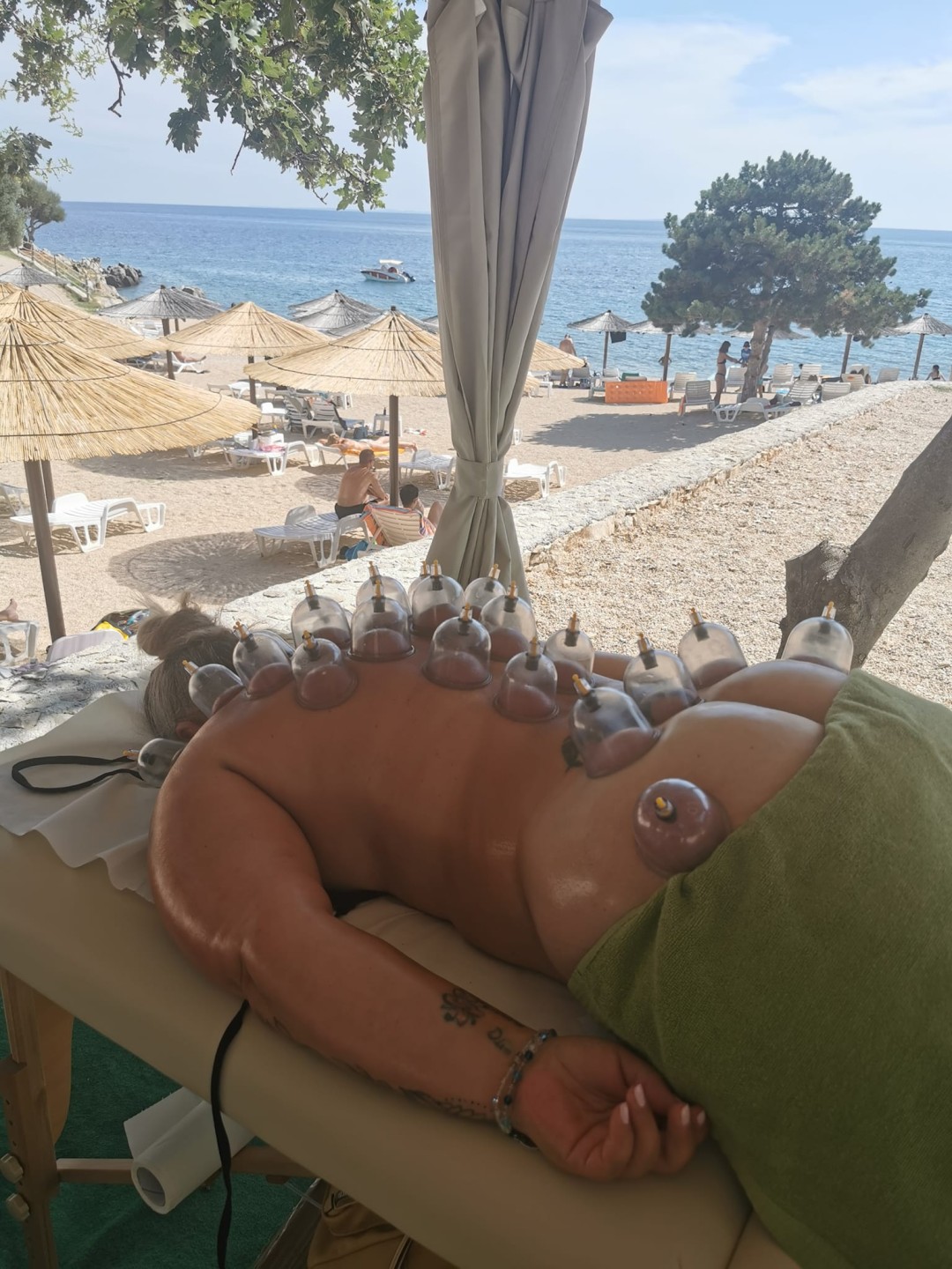 Cupping terapija + medicinska / sportska masaža - Nirvana Life Therapy, Zagreb Detoksikacija tijela Tijelo Detoksikacija tijela, Zagreb, Gornja Dubrava