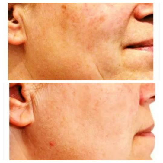 Antiage beauty room Lady Goga #zagreb Tretman lica