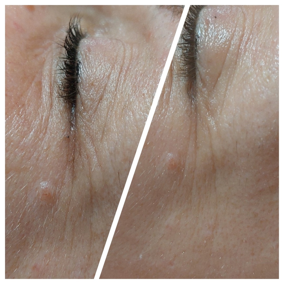 Antiage beauty room Lady Goga #zagreb Tretman lica