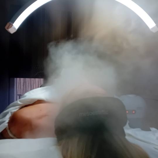 Skinergy #zagreb Tretman lica Mezoterapija - doplata za enzimski / mehanički piling