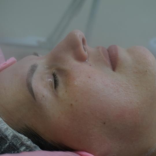 Le beauty by K #osijek Tretman lica Klasično čišćenje lica