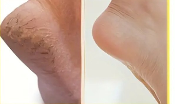 Luna Beauty studio #zagreb Estetska pedikura Ruska pedikura