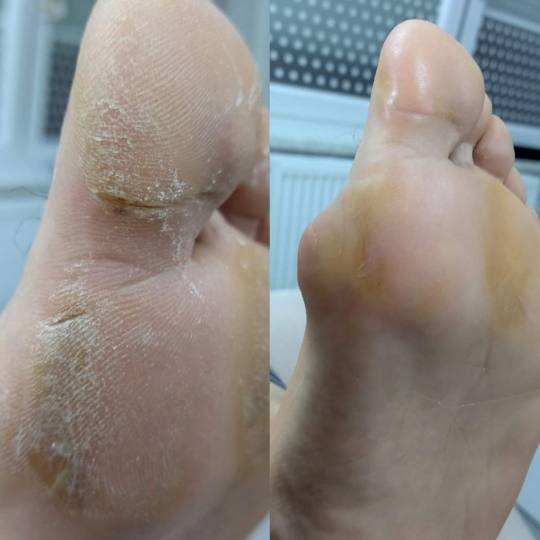 Boba Nail Bar #zagreb Estetska pedikura Ruska pedikura Ruska pedikura je prilično nova tehnika skid