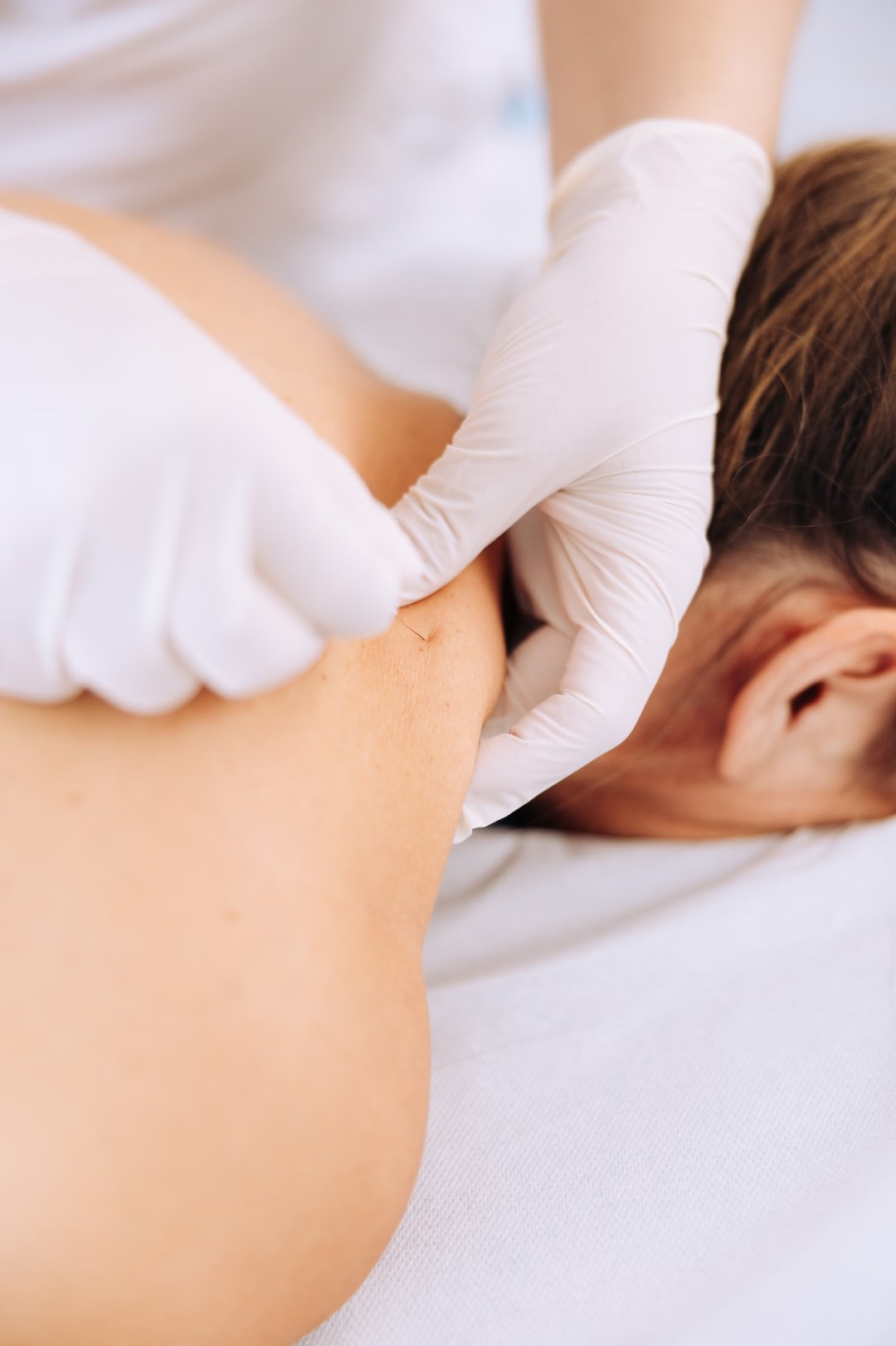 Fizio for You #zagreb Tretmani tijela Dry needling + compex - paket od 2 tretmana + 3 paketa masaža