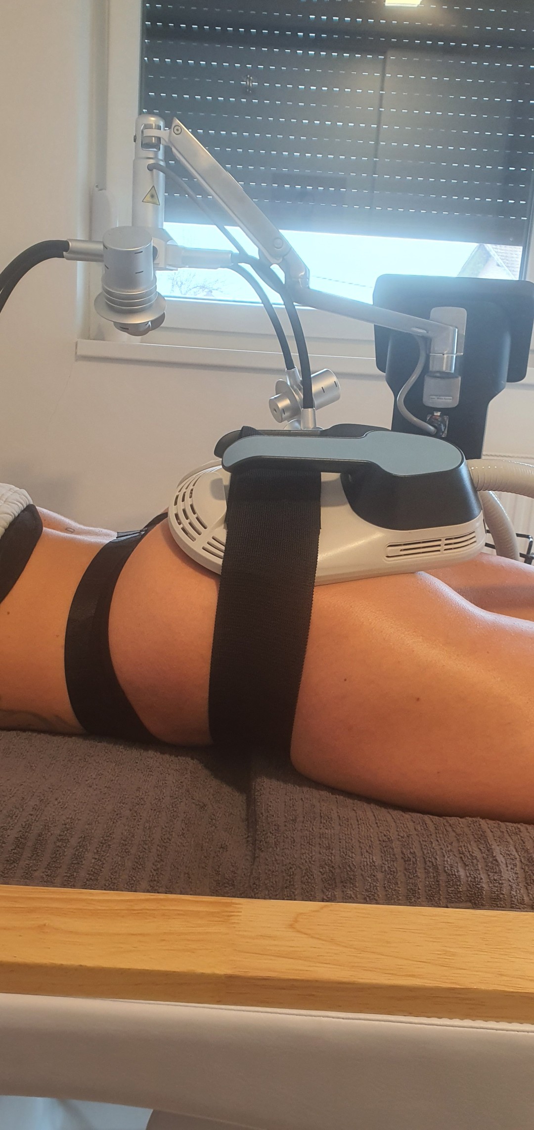 SOLO Beauty Centar #zagreb Tretmani tijela EMSZero 4 aplikatora -2 zone - 30 minuta