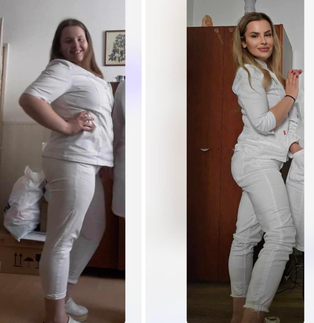 Estetix centar #zagreb Tretmani tijela Mega paket tretmana