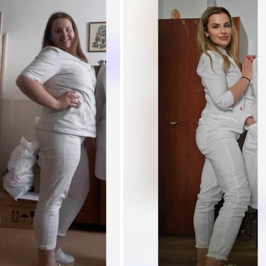 Estetix centar #zagreb Tretmani tijela Mega paket tretmana