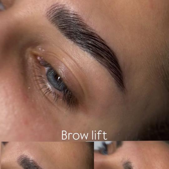 Moel beauty usluga