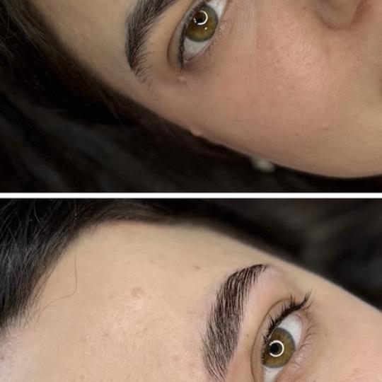 Anova Aesthetics #zagreb Obrve Brow lift Brow & Lash lift