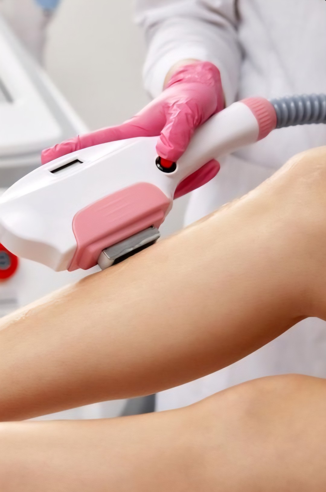 Slana soba Maris #zagreb Epilacija IPL aparatom IPL / SHR laserska epilacija cijelih nogu - za dame