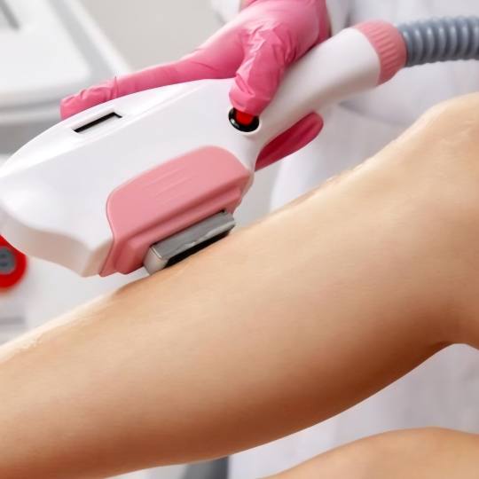 Slana soba Maris #zagreb Epilacija IPL aparatom IPL / SHR laserska epilacija cijelih nogu - za dame 