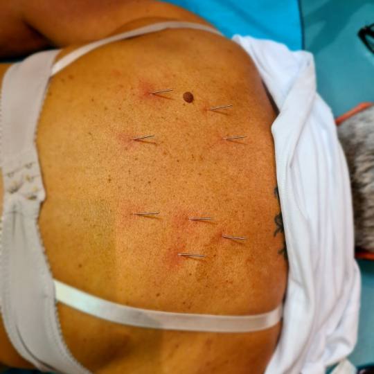 Čarobni dodir #osijek