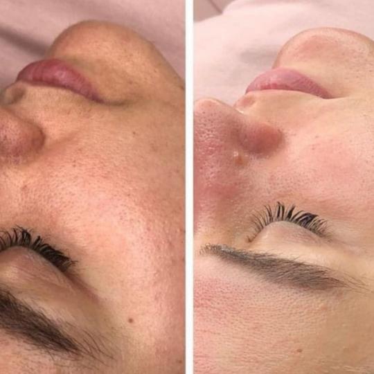 Perfect body beauty bar usluga