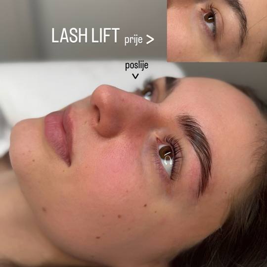 MOELL beauty #zagreb Trepavice Lash lift + bojanje + 3D filler