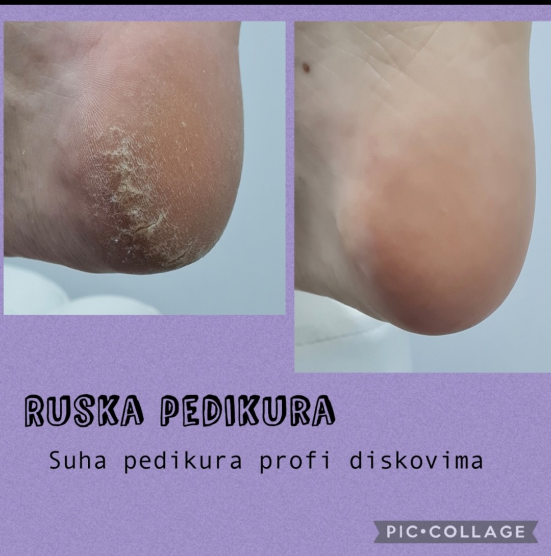 Jonno Nails #zagreb Estetska pedikura Ruska pedikura- estetska, NE MEDICINSKA