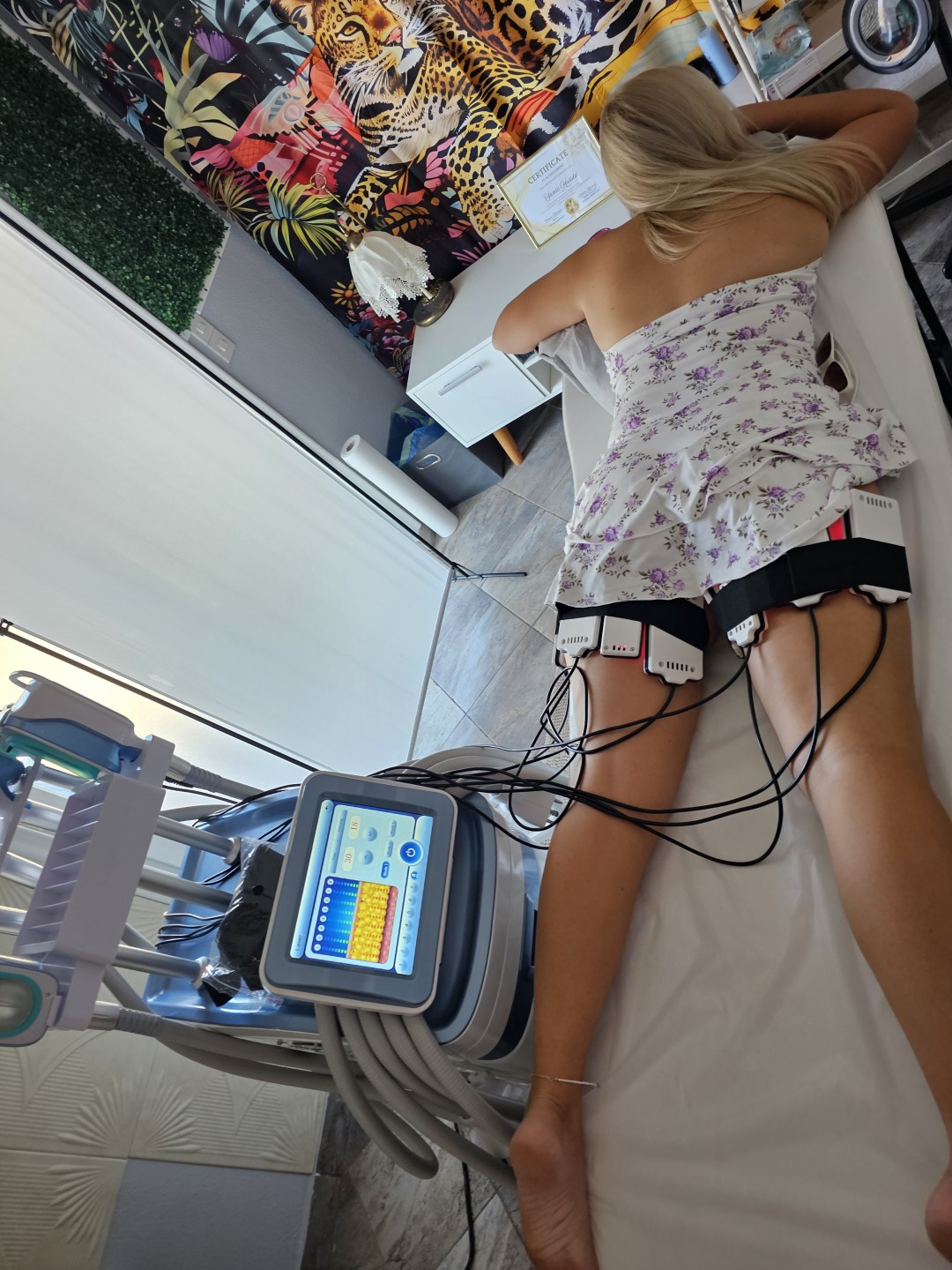 S M Beauty Bloom #zadar Tretmani tijela Lipo laser