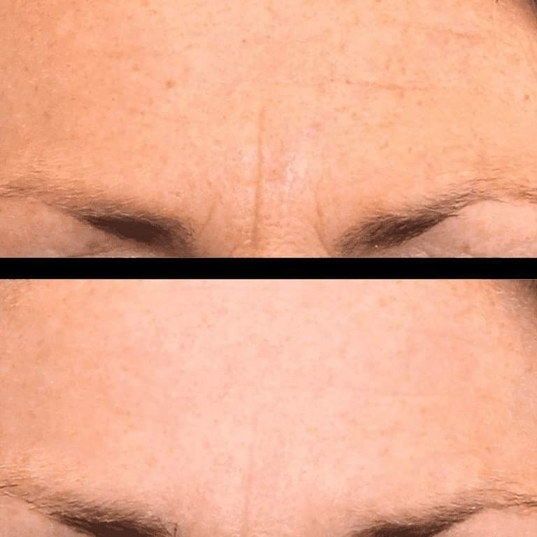 Antiage beauty room Lady Goga #zagreb Tretman lica