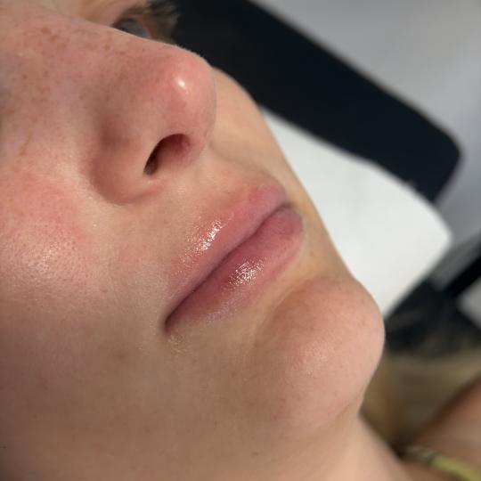 Théa Beauty Spot usluga