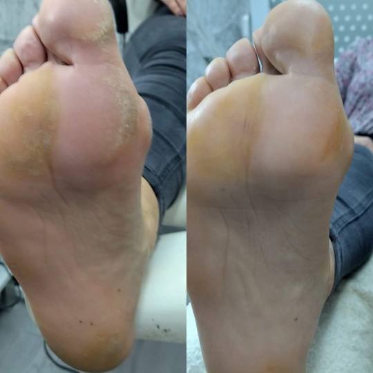 Boba Nail Bar #zagreb Estetska pedikura Ruska pedikura