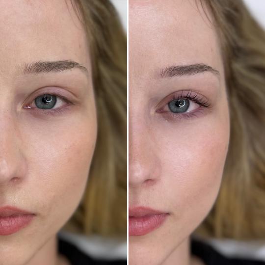 Anova Aesthetics #zagreb Trepavice Korejski lash lift + bojanje trepavica