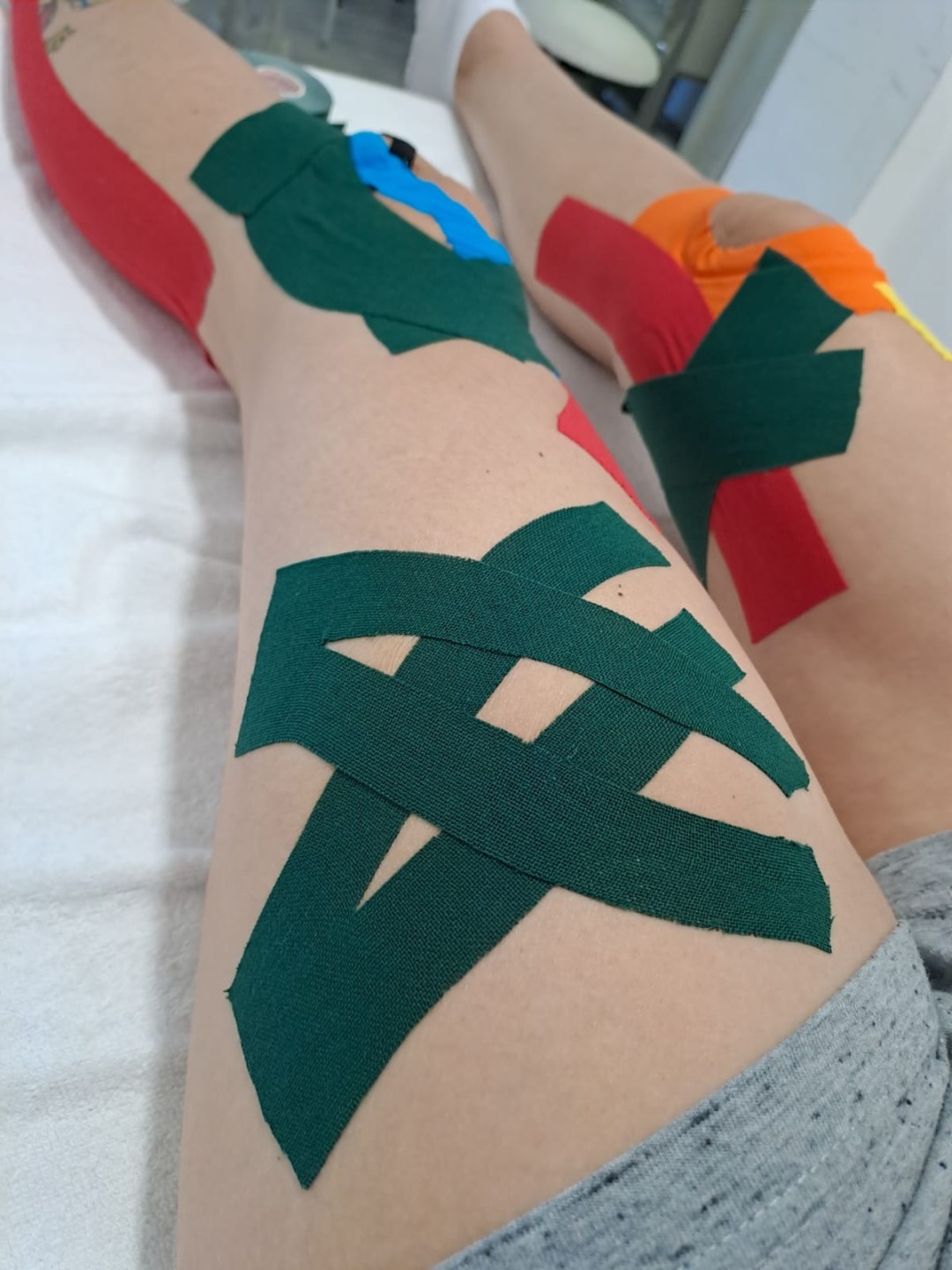 Gelaxy x Motus #zagreb Terapeutski tretmani Kinesiotaping - aplikacija po segmentu