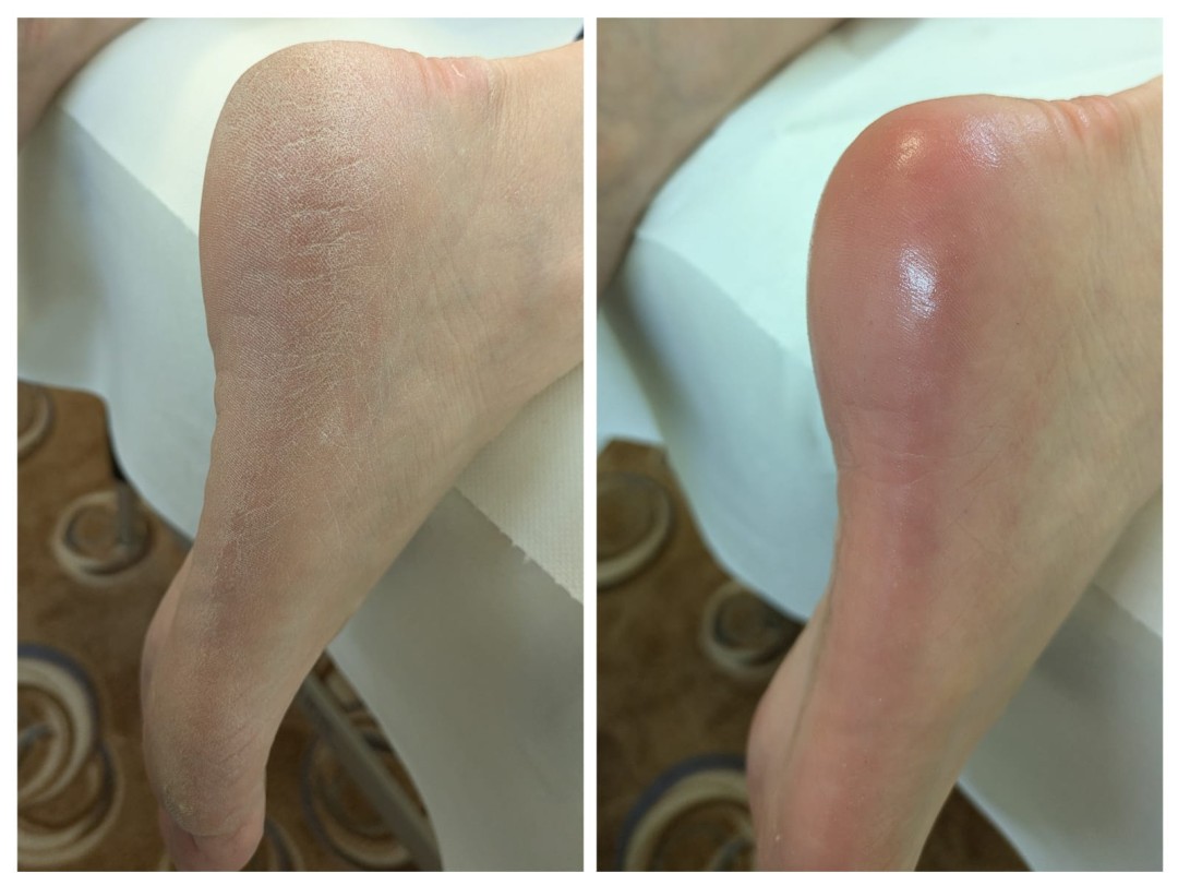 Gelaxy x Motus #zagreb Estetska pedikura Suha ruska pedikura + callux tretman