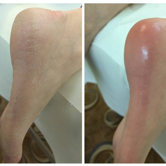 Gelaxy x Motus #zagreb Estetska pedikura Suha ruska pedikura + callux tretman