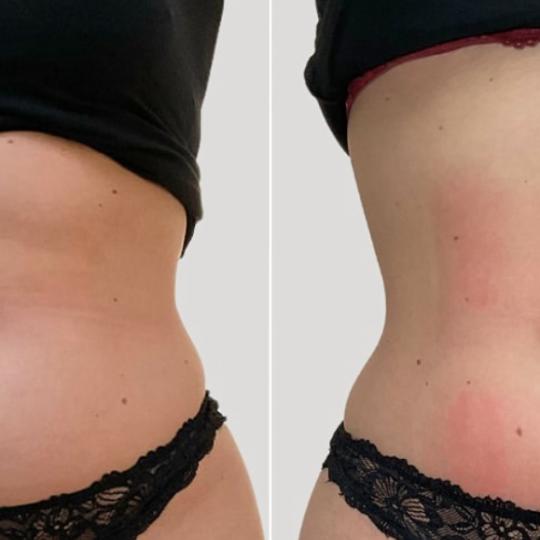 Perfect body beauty bar usluga