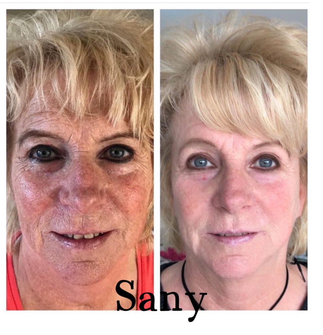 Sany Nails & Cosmetics #zagreb Tretman lica