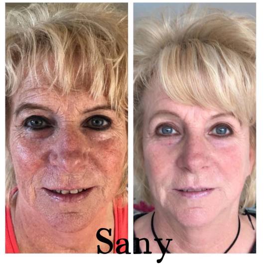 Sany Nails & Cosmetics #zagreb Tretman lica  ACCOR Cosmetics Corrector je nježna alternativa operac