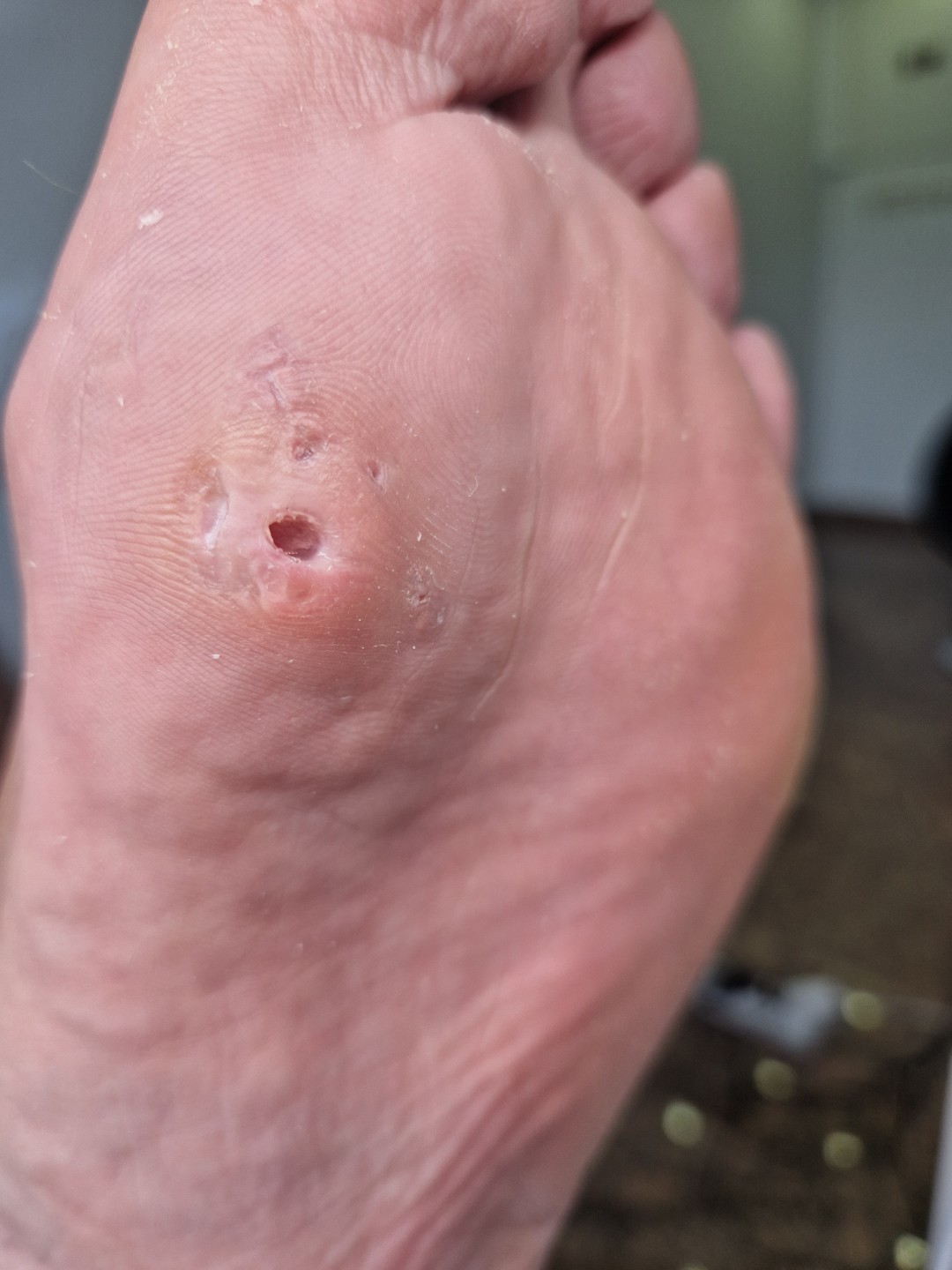 Maja #zagreb Medicinska pedikura Pedikura