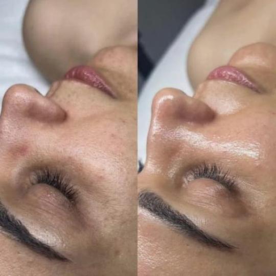 Aura Bliss usluga