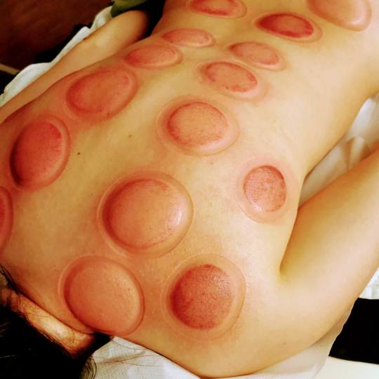 Nirvana Life Therapy usluga