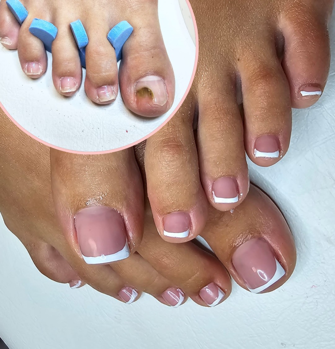 Aroma Sanja beauty & više #zagreb Estetska pedikura Ugradnja umjetnih noktiju gelom - noge