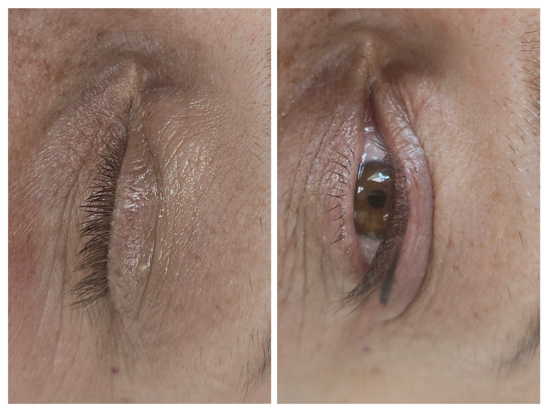 Cosmoderm & Centar Estetica #zagreb Trajna šminka Trajna šminka eyeliner shading