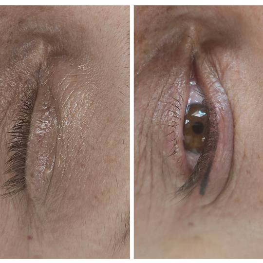 Cosmoderm & Centar Estetica #zagreb Trajna šminka Trajna šminka eyeliner shading